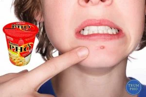 an pho goi co noi mun 1